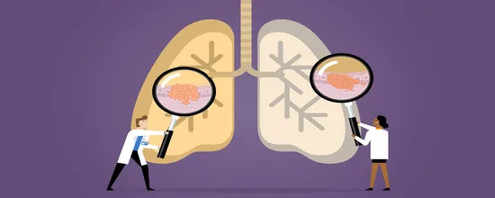 10 Early Signs You Might Have Lung Cancer